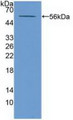 Western Blot; Sample: Recombinant ABCA13, Mouse.