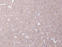 DAB staining on IHC-P; Samples: Rat Heart Tissue;  Primary Ab: 20µg/ml Rabbit Anti-Rat ABCA9 Antibod