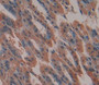 Used in DAB staining on fromalin fixed paraffin- embedded stomach tissue