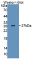 Western Blot; Sample: Recombinant protein.