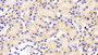 DAB staining on IHC-P; Samples: Mouse Kidney Tissue;  Primary Ab: 10μg/ml Rabbit Anti-Mouse ABCA5 Antibody Second Ab: 2µg/mL HRP-Linked Caprine Anti-Rabbit IgG Polyclonal Antibody 