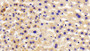 DAB staining on IHC-P; Samples: Mouse Liver Tissue;  Primary Ab: 10μg/ml Rabbit Anti-Mouse ABCF1 Antibody Second Ab: 2µg/mL HRP-Linked Caprine Anti-Rabbit IgG Polyclonal Antibody 