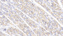 DAB staining on IHC-P; Samples: Human Stomach Tissue;  Primary Ab: 20μg/ml Rabbit Anti-Human ABCF1 Antibody Second Ab: 2µg/mL HRP-Linked Caprine Anti-Rabbit IgG Polyclonal Antibody 