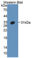 Western Blot; Sample: Recombinant protein.