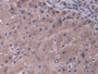 DAB staining on IHC-P; Samples: Human Liver Tissue; Primary Ab: 20µg/ml Rabbit Anti-Human ABCB11 Antibody Second Ab: 2µg/mL HRP-Linked Caprine Anti-Rabbit IgG Polyclonal Antibody