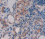 Used in DAB staining on fromalin fixed paraffin- embedded thyroid tissue
