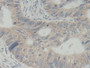 DAB staining on IHC-P. Samples: Human Tissue)