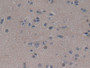 DAB staining on IHC-P; Samples: Human Brain Tissue.