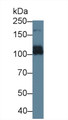 Western Blot; Sample: Rat Liver lysate; Primary Ab: 1µg/ml Rabbit Anti-Rat ABCC6 Antibody Second Ab: 0.2µg/mL HRP-Linked Caprine Anti-Rabbit IgG Polyclonal Antibody