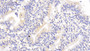 DAB staining on IHC-P; Samples: Human Small intestine Tissue; Primary Ab: 20μg/ml Rabbit Anti-Human ABCE1 Antibody Second Ab: 2µg/mL HRP-Linked Caprine Anti-Rabbit IgG Polyclonal Antibody
