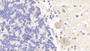 DAB staining on fromalin fixed paraffin- embedded rectum tissue)