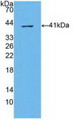 Western Blot; Sample: Recombinant ABCA4, Human.