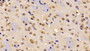 DAB staining on IHC-P; Samples: Mouse Cerebrum Tissue;  Primary Ab: 10μg/ml Rabbit Anti-Mouse ABCA2 Antibody Second Ab: 2µg/mL HRP-Linked Caprine Anti-Rabbit IgG Polyclonal Antibody 