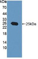 Western Blot; Sample: Recombinant PTP4A3, Human.