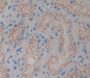 Used in DAB staining on fromalin fixed paraffin- embedded kidney tissue