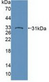 Western Blot; Sample: Recombinant PTPN22, Human.