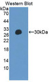 Western Blot; Sample: Recombinant protein.