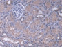 DAB staining on IHC-P; Samples: Human Kidney Tissue;  Primary Ab: 20µg/ml Rabbit Anti-Human MAPK13 A