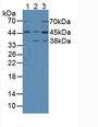 Western Blot; Sample: Lane1: Mouse Brain Tissue; Lane2: Mouse Kidney Tissue; Lane3: Rat Brain Tissue.