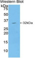 Western Blot; Sample: Recombinant protein.