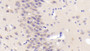 DAB staining on IHC-P; Samples: Mouse Cerebrum Tissue;  Primary Ab: 20μg/ml Rabbit Anti-Mouse MAP2K7 Antibody Second Ab: 2µg/mL HRP-Linked Caprine Anti-Rabbit IgG Polyclonal Antibody 