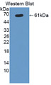 Western Blot; Sample: Recombinant protein.