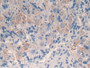DAB staining on IHC-P; Samples: Mouse Ovary Tissue; Primary Ab: 30µg/ml Rabbit Anti-Mouse CYP11A1 Antibody Second Ab: 2µg/mL HRP-Linked Caprine Anti-Rabbit IgG Polyclonal Antibody