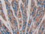DAB staining on IHC-P; Samples: Mouse Stomach Tissue;  Primary Ab: 10µg/ml Rabbit Anti-Mouse CYP24A1