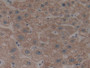 DAB staining on IHC-P; Samples: Human Liver Tissue;  Primary Ab: 10µg/ml Rabbit Anti-Human CYP26B1 A