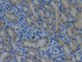 DAB staining on IHC-P; Samples: Mouse Kidney Tissue; Primary Ab: 10µg/ml Rabbit Anti-Mouse CYP26A1 Antibody Second Ab: 2µg/mL HRP-Linked Caprine Anti-Rabbit IgG Polyclonal Antibody