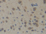DAB staining on fromalin fixed paraffin- embedded brain tissue)