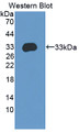 Western Blot; Sample: Recombinant protein.