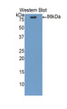 Western Blot; Sample: Recombinant protein.