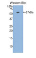 Western Blot; Sample: Recombinant protein.