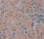 Heat Shock 70Kda Protein 14 (Hspa14) Polyclonal Antibody, Cat#CAU23304