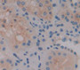 Pappalysin 2 (Pappa2) Polyclonal Antibody, Cat#CAU23307