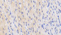 DAB staining on IHC-P; Samples: Human Cardiac Muscle Tissue; Primary Ab: 20μg/ml Rabbit Anti-Human HIF2a Antibody Second Ab: 2µg/mL HRP-Linked Caprine Anti-Rabbit IgG Polyclonal Antibody