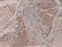 DAB staining on IHC-P; Samples: Human Esophagus Tissue.