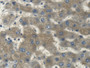 DAB staining on IHC-P; Samples: Human Liver Tissue; Primary Ab: 20µg/ml Rabbit Anti-Human MYH14 Antibody Second Ab: 2µg/mL HRP-Linked Caprine Anti-Rabbit IgG Polyclonal Antibody