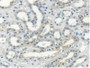 DAB staining on IHC-P; Samples: Human Kidney Tissue.