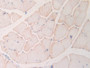 DAB staining on IHC-P; Samples: Rat Skeletal muscle Tissue; Primary Ab: 10µg/ml Rabbit Anti-Rat MYL6B Antibody Second Ab: 2µg/mL HRP-Linked Caprine Anti-Rabbit IgG Polyclonal Antibody