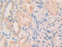 DAB staining on IHC-P; Samples: Human Kidney Tissue; Primary Ab: 10µg/ml Rabbit Anti-Human MYO1C Antibody Second Ab: 2µg/mL HRP-Linked Caprine Anti-Rabbit IgG Polyclonal Antibody