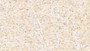 DAB staining on IHC-P; Samples: Human Cardiac Muscle Tissue; Primary Ab: 20μg/ml Rabbit Anti-Human MYLK3 Antibody Second Ab: 2µg/mL HRP-Linked Caprine Anti-Rabbit IgG Polyclonal Antibody