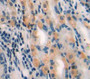 DAB staining on fromalin fixed paraffin-embedded stomach tissue)