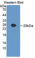 Western Blot; Sample: Recombinant protein.