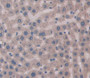 Myosin Heavy Chain 8, Skeletal Muscle, Perinatal (Myh8) Polyclonal Antibody, Cat#CAU23350