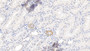 DAB staining on IHC-P; Samples: Human Kidney Tissue; Primary Ab: 10µg/ml Rabbit Anti-Human MYH11 Antibody Second Ab: 2µg/mL HRP-Linked Caprine Anti-Rabbit IgG Polyclonal Antibody