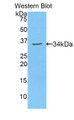 Western Blot; Sample: Recombinant protein.