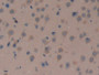 DAB staining on IHC-P; Samples: Mouse Brain Tissue; Primary Ab: 10µg/ml Rabbit Anti-Mouse DKK3 Antibody Second Ab: 2µg/mL HRP-Linked Caprine Anti-Rabbit IgG Polyclonal Antibody