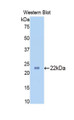 Western Blot; Sample: Recombinant protein.